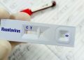 Warga Kulon Progo Suspek Virus Hanta Akhirnya Dinyatakan Negatif