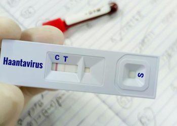 Warga Kulon Progo Suspek Virus Hanta Akhirnya Dinyatakan Negatif