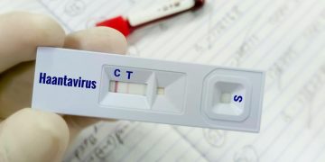 Warga Kulon Progo Suspek Virus Hanta Akhirnya Dinyatakan Negatif