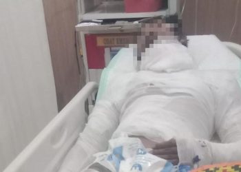 Sopir Truk Bali yang Dibakar Bosnya Meninggal Dunia Setelah Seminggu Kritis